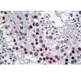 Immunohistochemistry - Anti-DENTT Antibody (A83796) - Antibodies.com