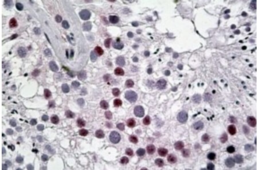 Immunohistochemistry - Anti-DENTT Antibody (A83796) - Antibodies.com