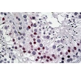 Immunohistochemistry - Anti-TSPYL2 Antibody (A83796) - Antibodies.com