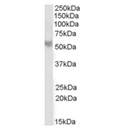 Western Blot - Anti-PPP2R5B Antibody (A83797) - Antibodies.com