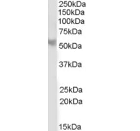 Western Blot - Anti-PPP2R5B Antibody (A83797) - Antibodies.com