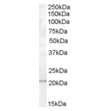 Western Blot - Anti-PRL-1 Antibody (A83798) - Antibodies.com