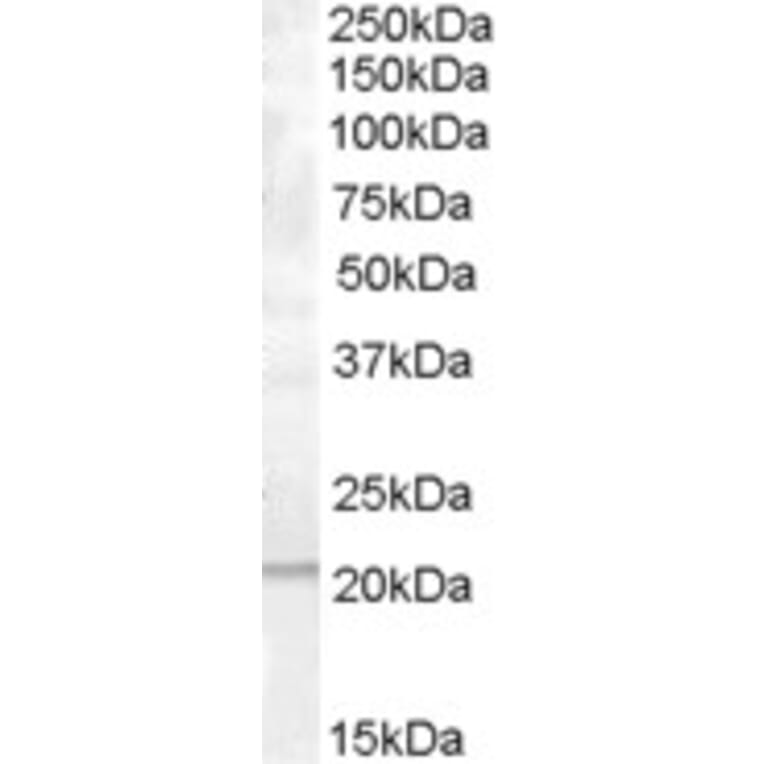 Western Blot - Anti-PRL-1 Antibody (A83798) - Antibodies.com