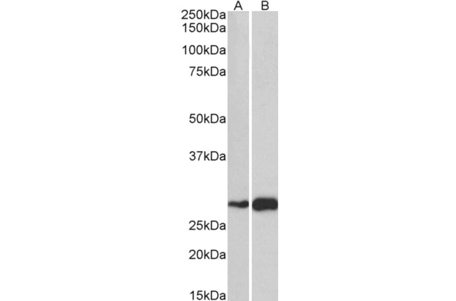Western Blot - Anti-ATF5 Antibody (A83799) - Antibodies.com