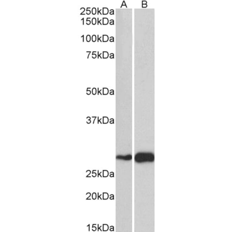 Western Blot - Anti-ATF5 Antibody (A83799) - Antibodies.com