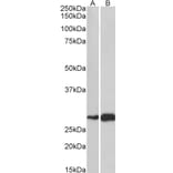Western Blot - Anti-ATF5 Antibody (A83799) - Antibodies.com