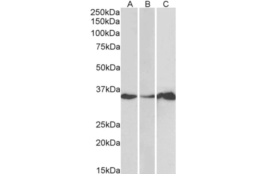 Western Blot - Anti-LASP1 Antibody (A83800) - Antibodies.com