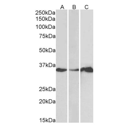 Western Blot - Anti-LASP1 Antibody (A83800) - Antibodies.com