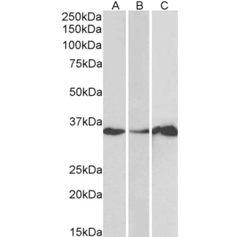 Western Blot - Anti-LASP1 Antibody (A83800) - Antibodies.com