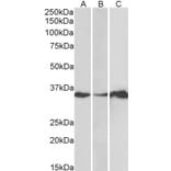 Western Blot - Anti-LASP1 Antibody (A83800) - Antibodies.com