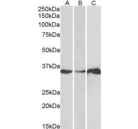 Western Blot - Anti-LASP1 Antibody (A83800) - Antibodies.com