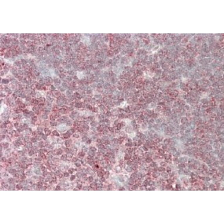 Immunohistochemistry - Anti-CrkL Antibody (A83801) - Antibodies.com