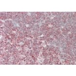Immunohistochemistry - Anti-CrkL Antibody (A83801) - Antibodies.com