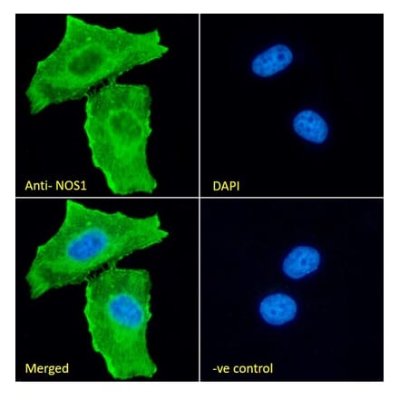 Immunofluorescence - Anti-n-NOS Antibody (A83802) - Antibodies.com