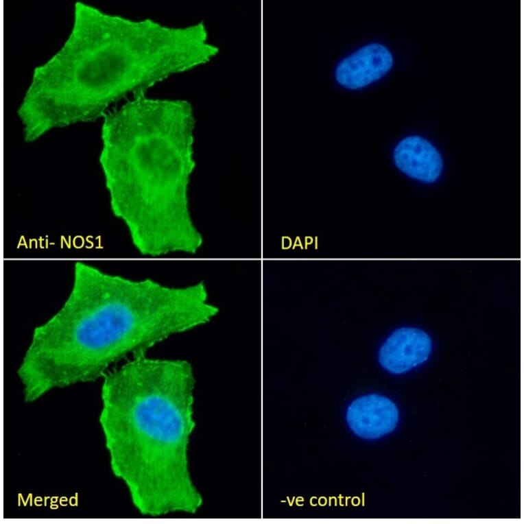 Immunofluorescence - Anti-n-NOS Antibody (A83802) - Antibodies.com