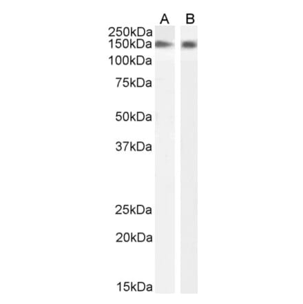 Western Blot - Anti-NOS1 Antibody (A83802)