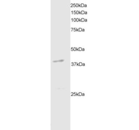 Western Blot - Anti-DAPK2 Antibody (A83804) - Antibodies.com