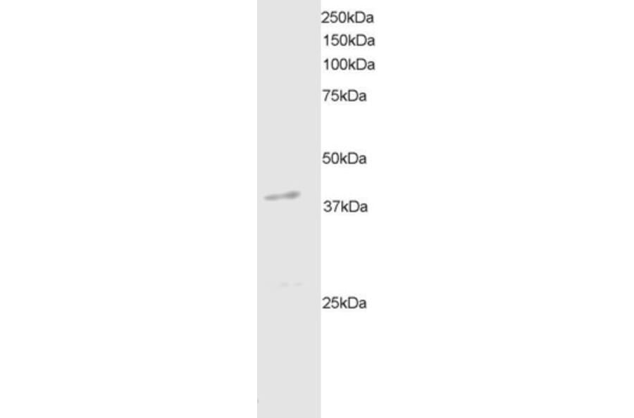 Western Blot - Anti-DAPK2 Antibody (A83804) - Antibodies.com