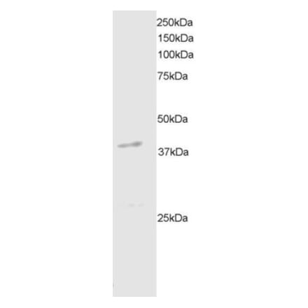 Western Blot - Anti-DAPK2 Antibody (A83804) - Antibodies.com