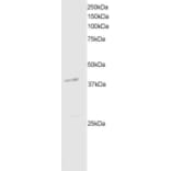 Western Blot - Anti-DAPK2 Antibody (A83804) - Antibodies.com