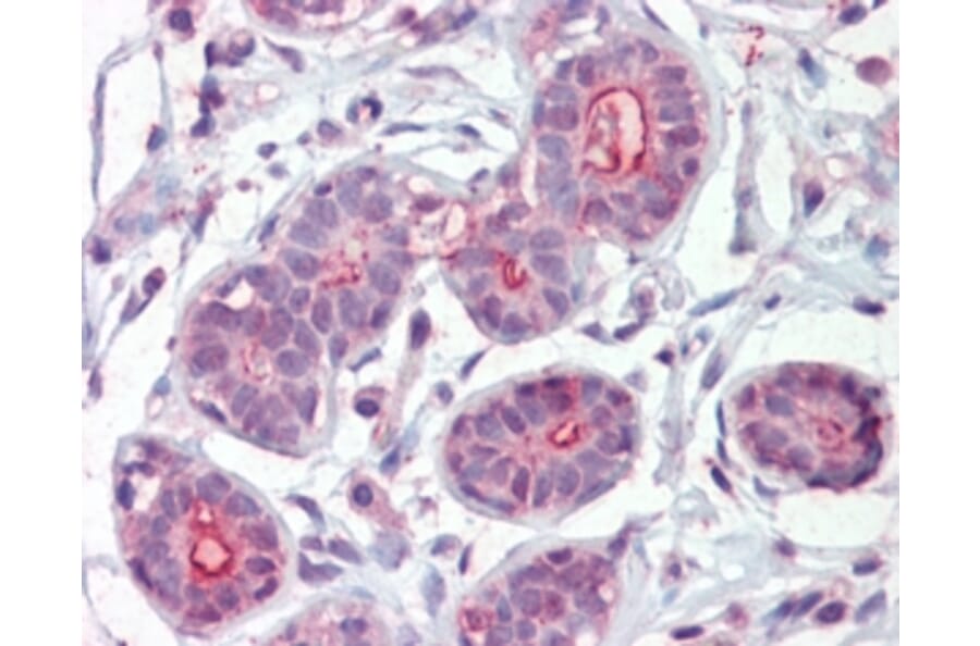 Immunohistochemistry - Anti-DAPK2 Antibody (A83804) - Antibodies.com