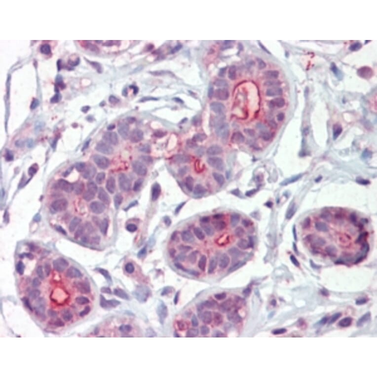 Immunohistochemistry - Anti-DAPK2 Antibody (A83804) - Antibodies.com