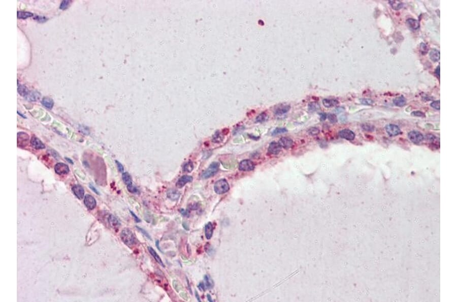 Immunohistochemistry - Anti-DAPK2 Antibody (A83804) - Antibodies.com