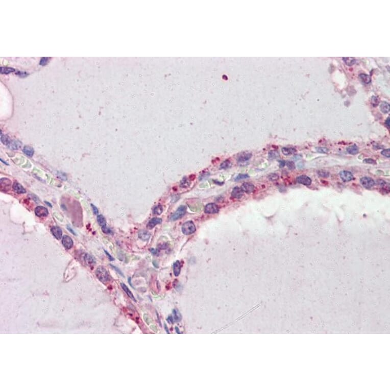 Immunohistochemistry - Anti-DAPK2 Antibody (A83804) - Antibodies.com