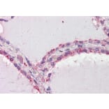 Immunohistochemistry - Anti-DAPK2 Antibody (A83804) - Antibodies.com