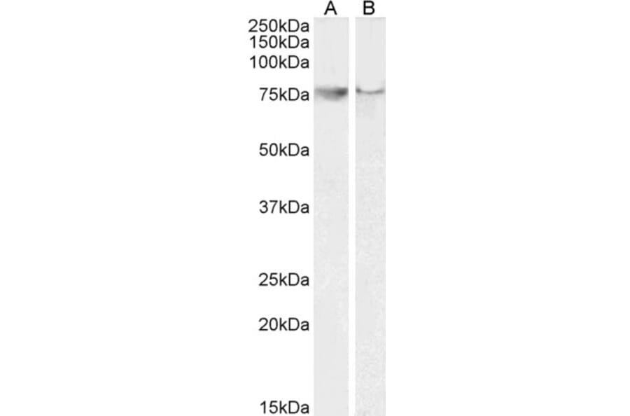 Western Blot - Anti-COX2/Cyclooxygenase 2 Antibody (A83806) - Antibodies.com