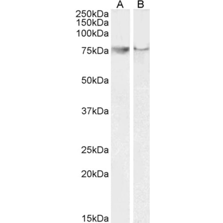 Western Blot - Anti-COX2/Cyclooxygenase 2 Antibody (A83806) - Antibodies.com