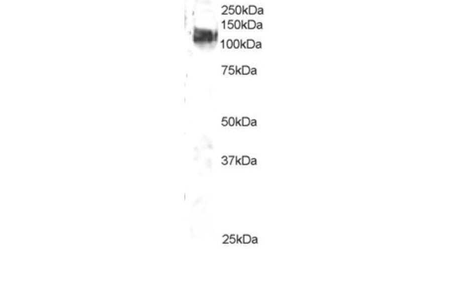 Western Blot - Anti-CBL Antibody (A83807) - Antibodies.com