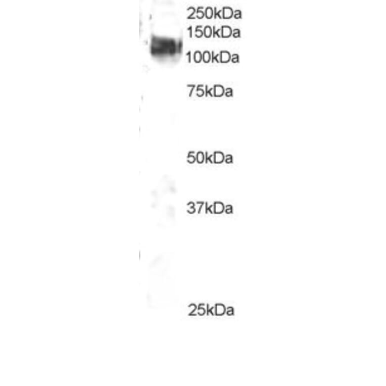 Western Blot - Anti-CBL Antibody (A83807) - Antibodies.com