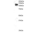 Western Blot - Anti-CBL Antibody (A83807) - Antibodies.com
