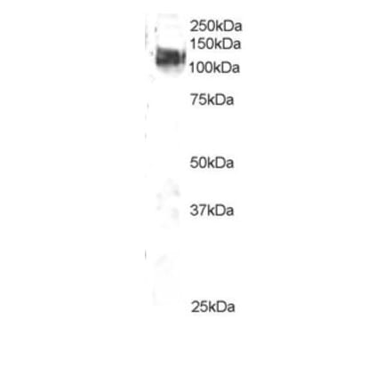Western Blot - Anti-CBL Antibody (A83807) - Antibodies.com