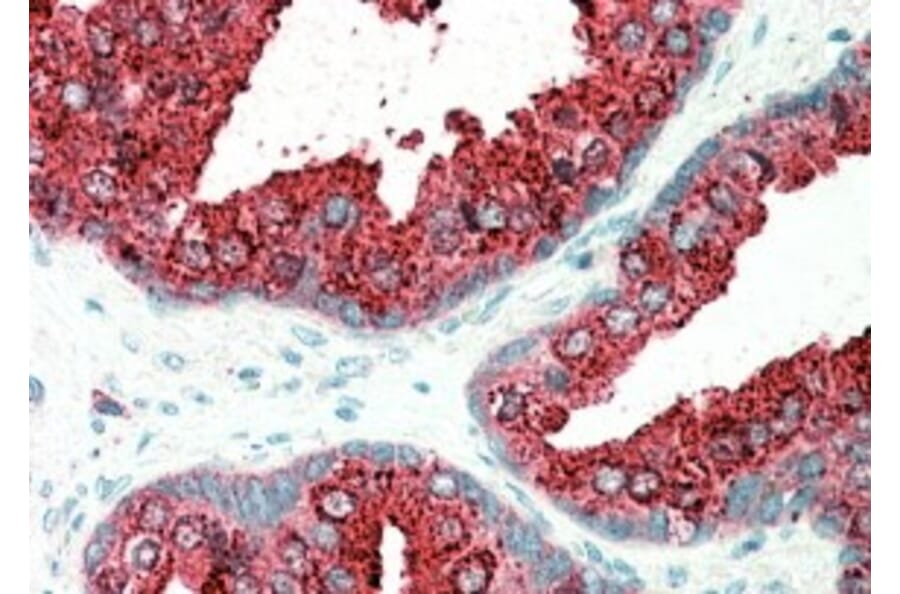 Immunohistochemistry - Anti-ELMO3 Antibody (A83808) - Antibodies.com