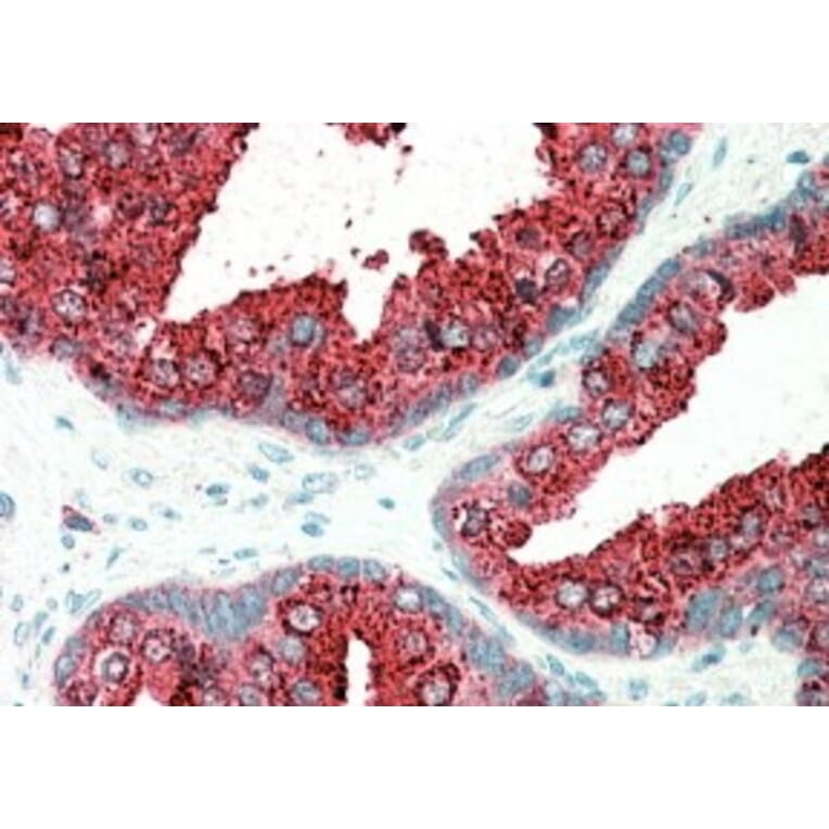 Immunohistochemistry - Anti-ELMO3 Antibody (A83808) - Antibodies.com