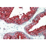 Immunohistochemistry - Anti-ELMO3 Antibody (A83808) - Antibodies.com