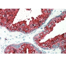 Immunohistochemistry - Anti-ELMO3 Antibody (A83808) - Antibodies.com