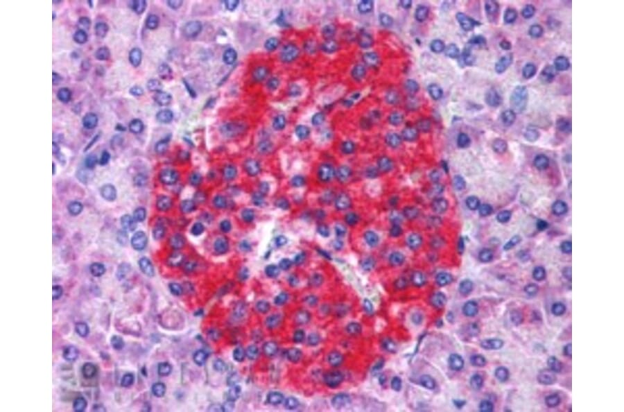 Immunohistochemistry - Anti-Annexin A10/ANXA10 Antibody (A83809) - Antibodies.com