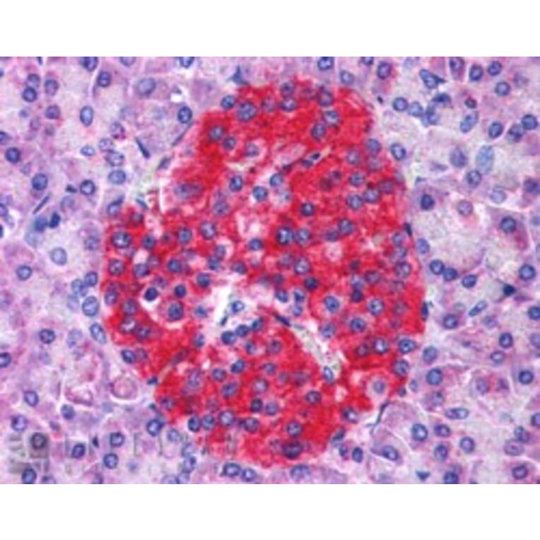 Immunohistochemistry - Anti-Annexin A10/ANXA10 Antibody (A83809) - Antibodies.com