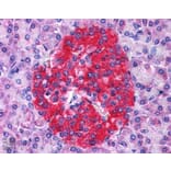Immunohistochemistry - Anti-Annexin A10/ANXA10 Antibody (A83809) - Antibodies.com