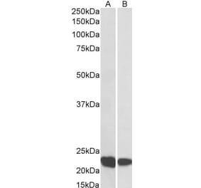 Western Blot - Anti-RAC2 Antibody (A83810) - Antibodies.com