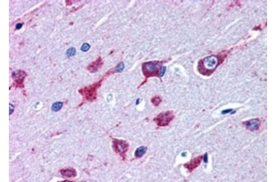 Immunohistochemistry - Anti-Als2 Antibody (A83811) - Antibodies.com