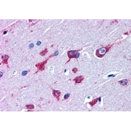 Immunohistochemistry - Anti-Als2 Antibody (A83811) - Antibodies.com