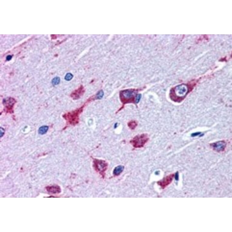 Immunohistochemistry - Anti-Als2 Antibody (A83811) - Antibodies.com