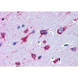 Immunohistochemistry - Anti-Als2 Antibody (A83811) - Antibodies.com