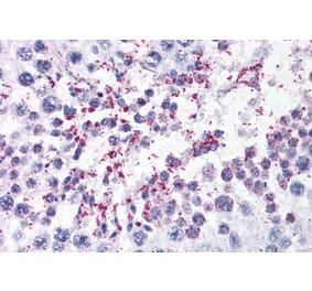 Immunohistochemistry - Anti-DUSP14 Antibody (A83812) - Antibodies.com