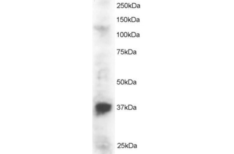 Western Blot - Anti-PINX1/LPTS Antibody (A83813) - Antibodies.com