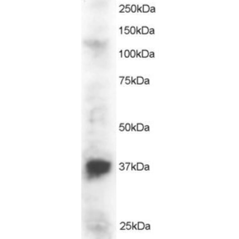 Western Blot - Anti-PINX1/LPTS Antibody (A83813) - Antibodies.com
